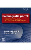 Colonografía Por Tc: Principios Y Práctica de la Colonoscopia Virtual
