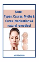 Acne: Types, Causes, Myths & Cures [medications & natural remedies}.