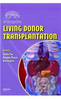 Living Donor Transplantation
