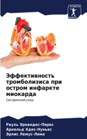 Эффективность тромболизиса при остром ин