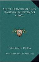 Acute Exantheme Und Hautkrankheiten V3 (1860)