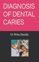 Diagnosis of Dental Caries