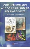 Cochlear Implants and Other Implantable Hearing Devices