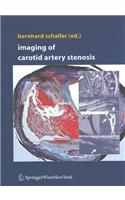 Imaging of Carotid Artery Stenosis