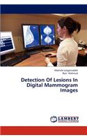 Detection of Lesions in Digital Mammogram Images