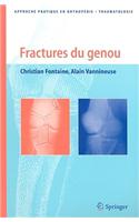 Fractures Du Genou
