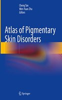 Atlas of Pigmentary Skin Disorders