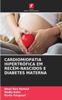 Cardiomiopatia Hipertrófica Em Recém-Nascidos E Diabetes Materna