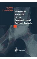 Avascular Necrosis of the Femoral Head: Current Trends