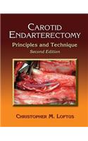 Carotid Endarterectomy