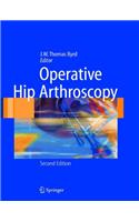 Operative Hip Arthroscopy