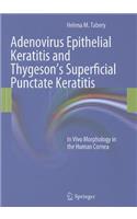 Adenovirus Epithelial Keratitis and Thygeson's Superficial Punctate Keratitis