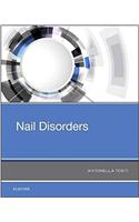 Nail Disorders