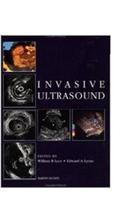 Invasive Ultrasound