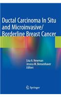 Ductal Carcinoma in Situ and Microinvasive/Borderline Breast Cancer