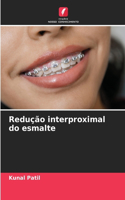 Redução interproximal do esmalte