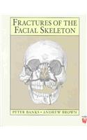 Fractures of the Facial Skeleton