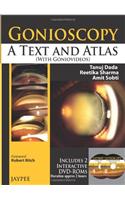 Gonioscopy: A Text and Atlas (with Goniovideos)