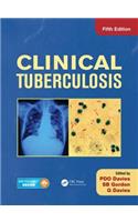 Clinical Tuberculosis