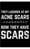 They Laughed At My Acne Scars Now They Have The Scars