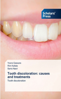 Tooth discoloration
