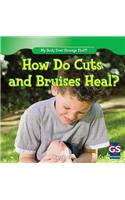 How Do Cuts and Bruises Heal?