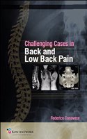 Challenging Cases in Back and Low Back Pain