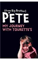 Pete