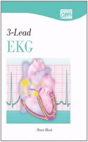 3-Lead EKG: Heart Block