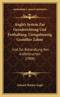 Angle's System Zur Geraderichtung Und Festhaltung, Unregalmassig Gestellter Zahne