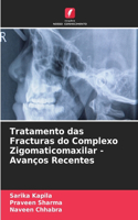 Tratamento das Fracturas do Complexo Zigomaticomaxilar - Avanços Recentes