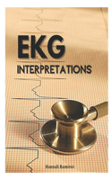 EKG Interpretations