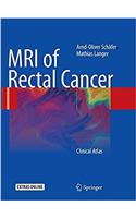 MRI of Rectal Cancer