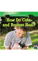 How Do Cuts and Bruises Heal?