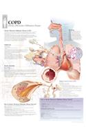 Copd Chart: Laminated Wall Chart