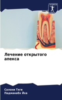 &#1051;&#1077;&#1095;&#1077;&#1085;&#1080;&#1077; &#1086;&#1090;&#1082;&#1088;&#1099;&#1090;&#1086;&#1075;&#1086; &#1072;&#1087;&#1077;&#1082;&#1089;&#1072;