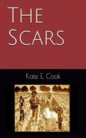 Scars