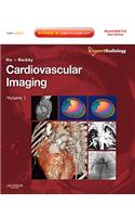 Cardiovascular Imaging, 2-Volume Set