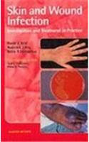 Skin and Wound Infection: Investigation and Treatment in Practice