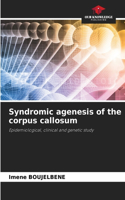 Syndromic agenesis of the corpus callosum