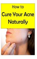 How to Cure Your Acne Naturally