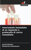 Inserimento immediato di un impianto e protocollo di carico immediato