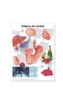 Dangers of Alcohol Anatomical Chart in Spanish (Peligros del alcohol)