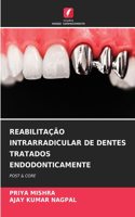 Reabilitação Intrarradicular de Dentes Tratados Endodonticamente