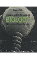 Scanning Electron Microscopy in Biology