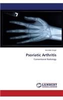Psoriatic Arthritis