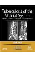 Tuberculosis of the Skeletal System