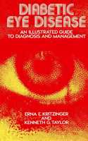 Diabetic Eye Disease