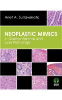 Neoplastic Mimics in Gastrointestinal and Liver Pathology