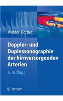 Doppler- Und Duplexsonographie der Hirnversorgenden Arterien